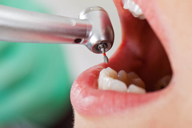 Best Pediatric Emergency Dentist in Mantua, VA
